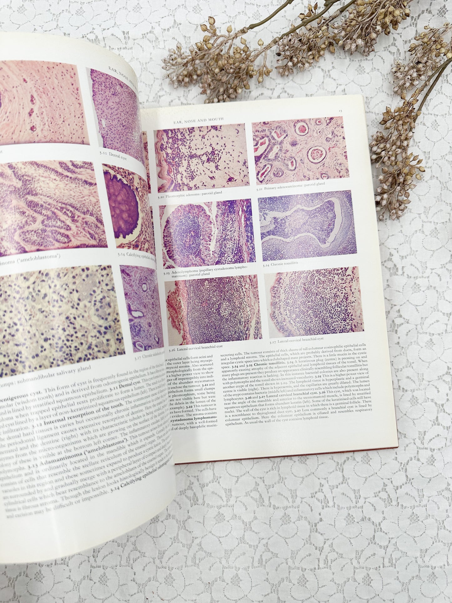 Color Atlas of Histopathology