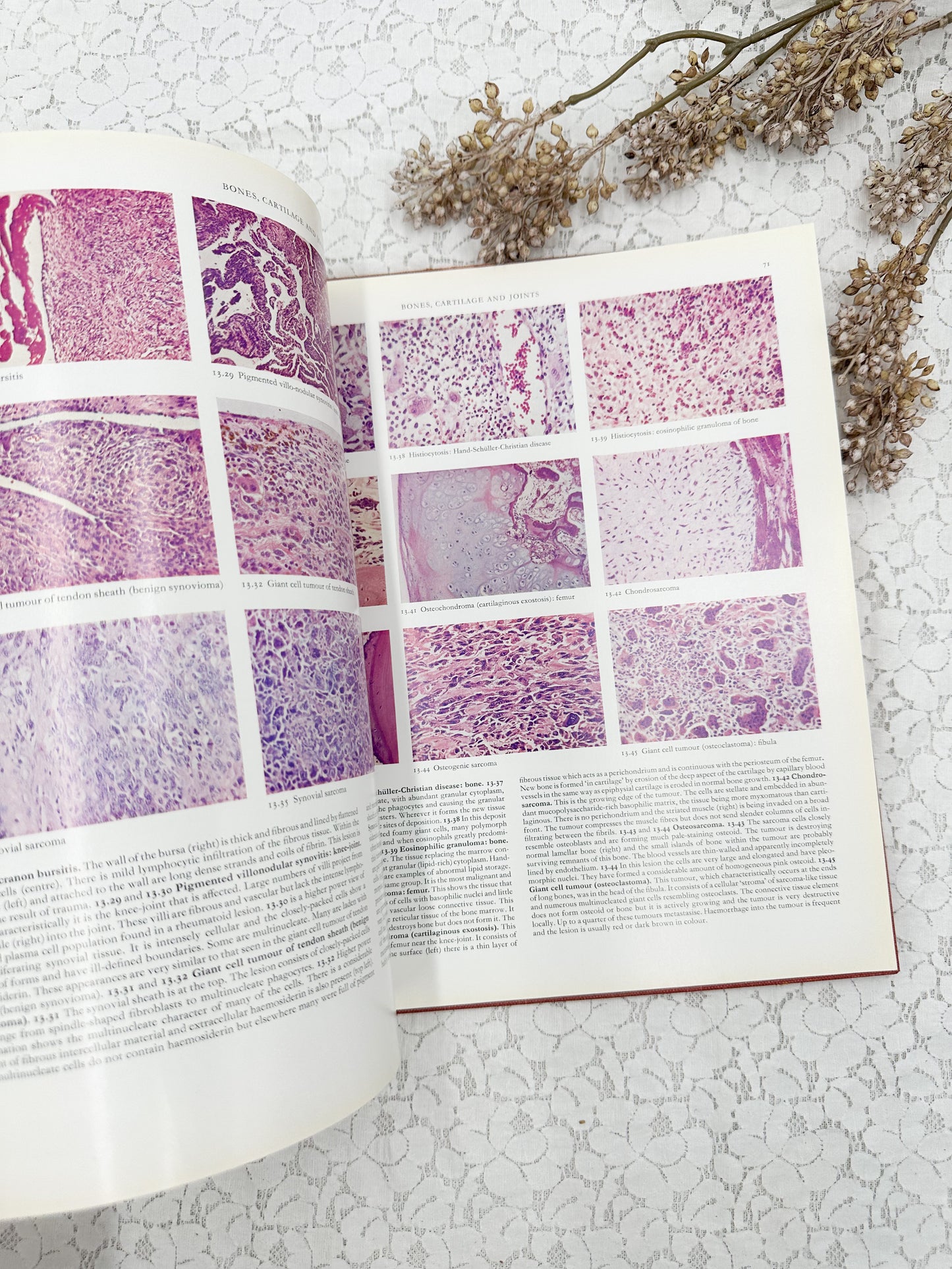 Color Atlas of Histopathology