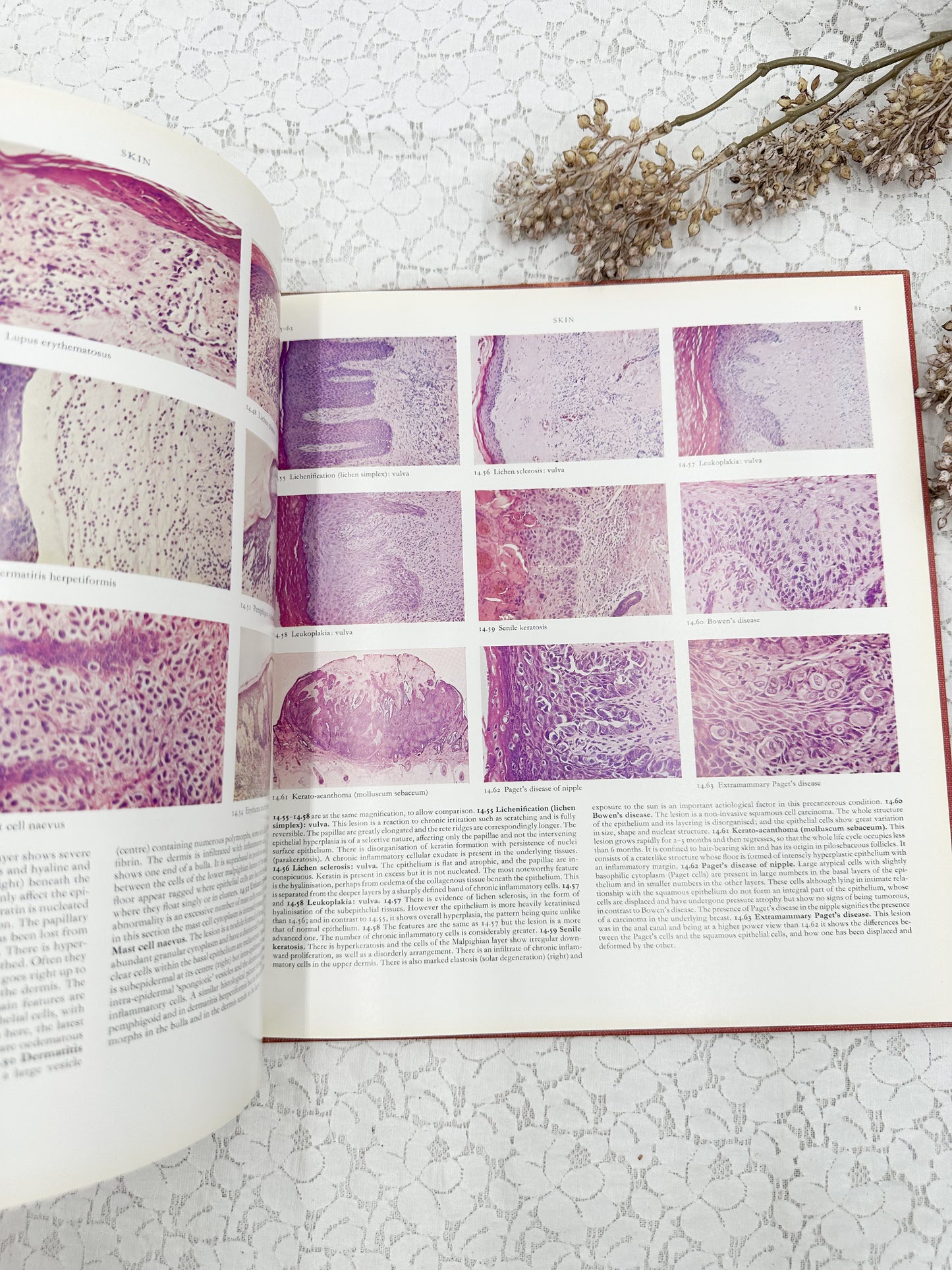 Color Atlas of Histopathology