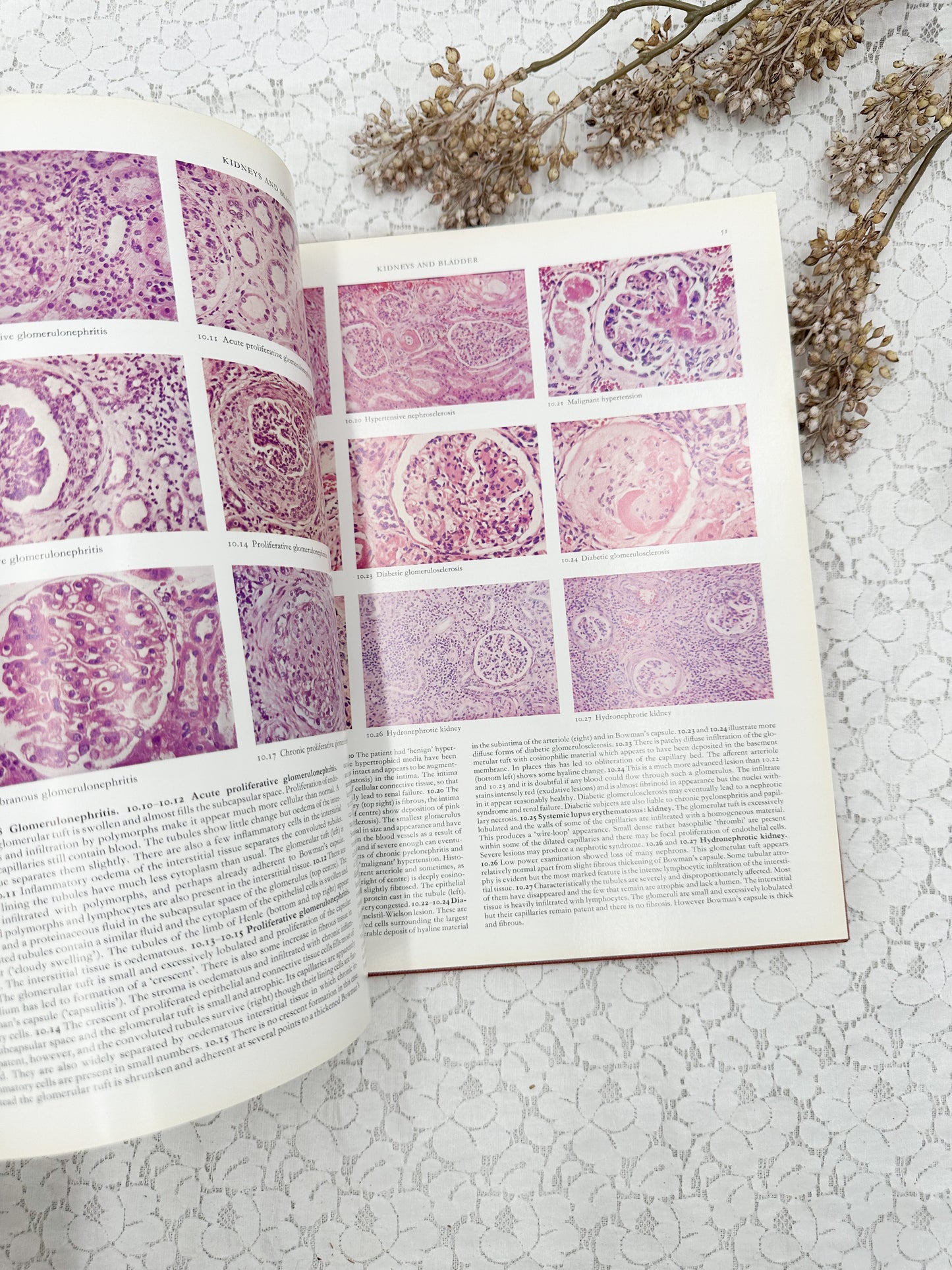 Color Atlas of Histopathology