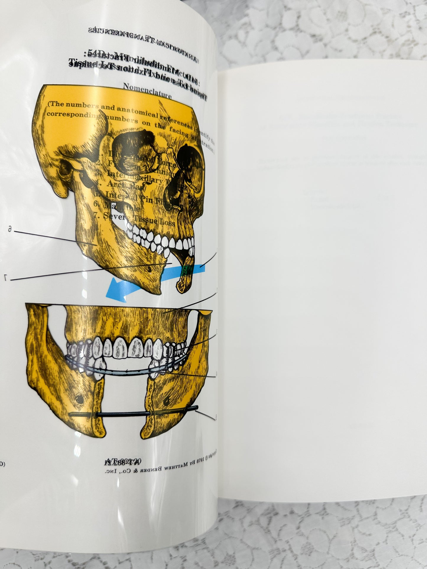 Textbook of Medicine- Two Available
