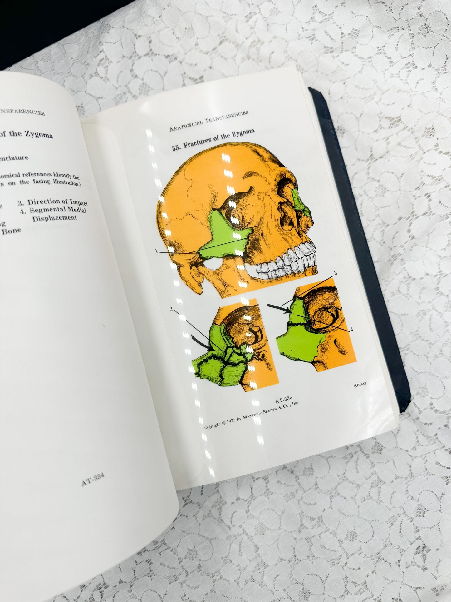 Textbook of Medicine- Two Available