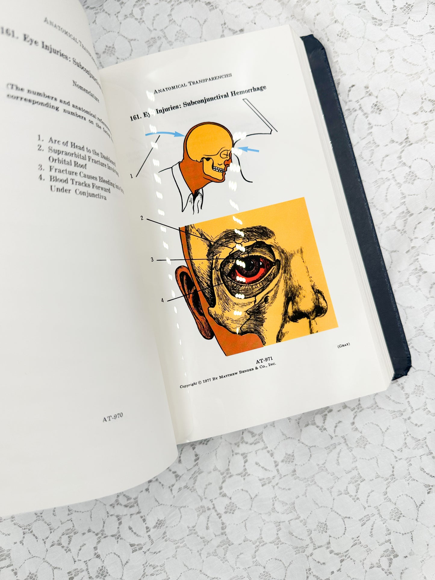 Textbook of Medicine- Two Available